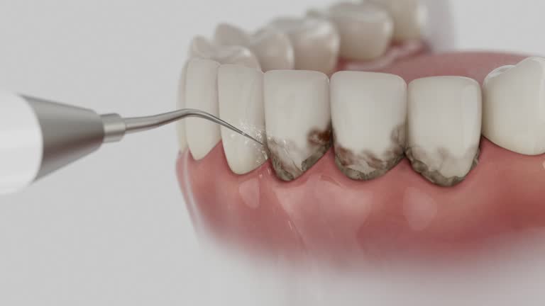 Trusted Dental Implants service in Westhaven-Moonstone, CA - Dentist Open Now